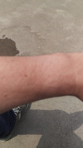 15308808620151852237499