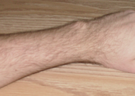 266px-Human_wrist